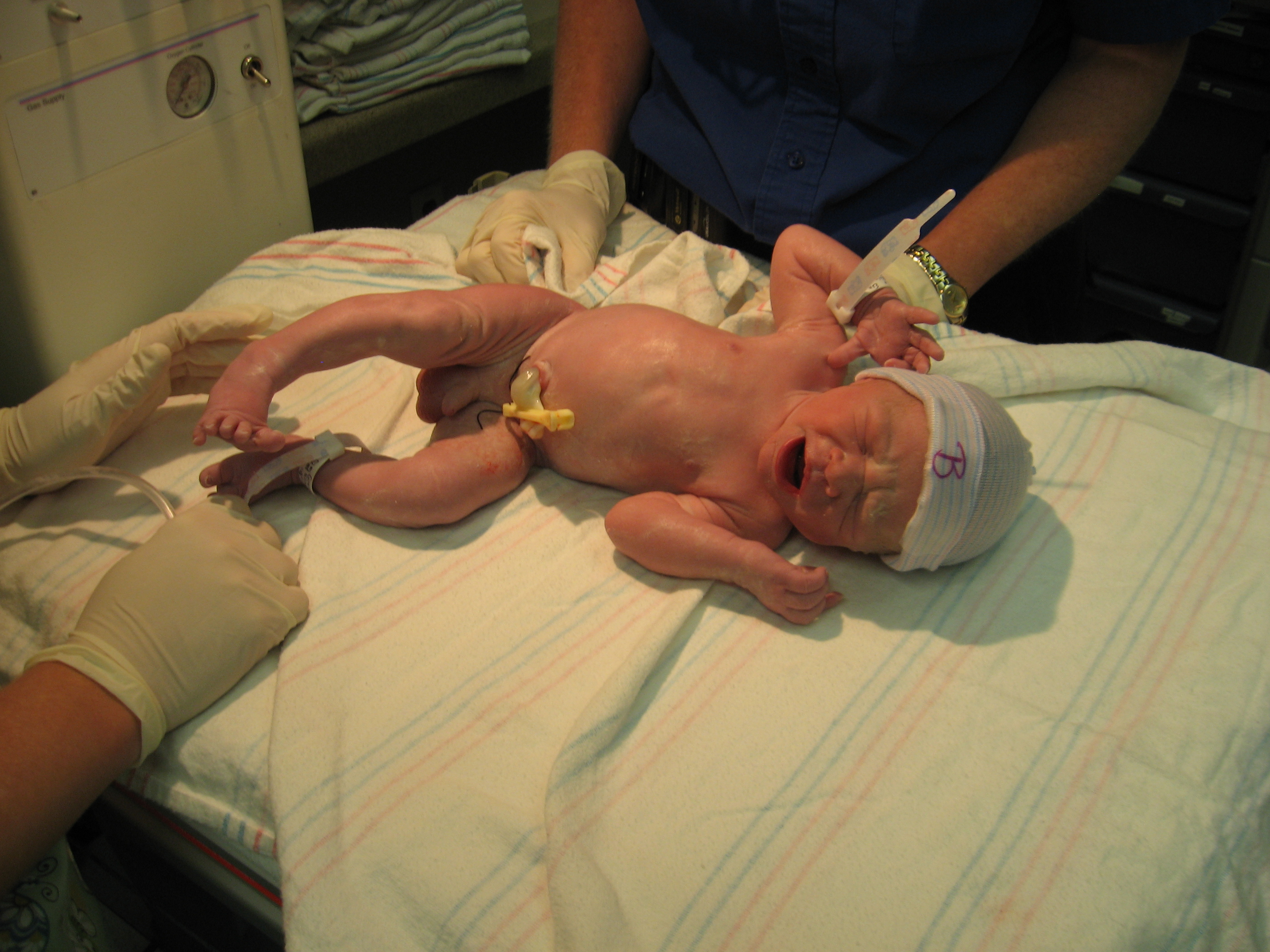 Index Of GreinerpicturesBabiesBirth